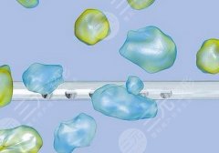 水动力吸脂手术多少钱?术后反弹和疼痛情况了解一下! 水动力吸脂手术多少钱?术后反弹和疼痛情况了解一下!