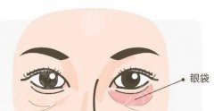 眼睛周围皮肤松弛怎么办？预防方法学起来！相关手术方案可了解和选择！