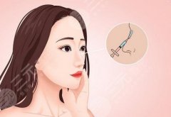 玻尿酸隆鼻贵吗?费用、维持时间以及可能的危害分享给你! 玻尿酸隆鼻贵吗?费用、维持时间以及可能的危害分享给你!