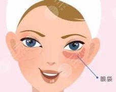 超声波去眼袋贵吗？一起来看看超声波去眼袋和激光去眼袋怎么选！