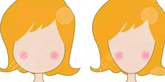 改脸型