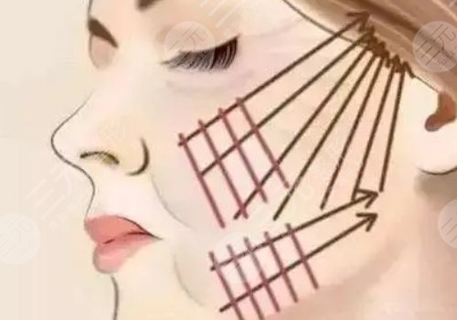 线雕适合多大年龄？