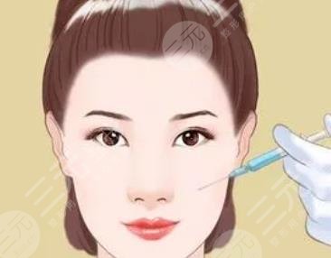 脂肪填充