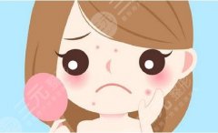 激光祛痘印注意事项？激光祛痘印的原理、价格、护理知识get！