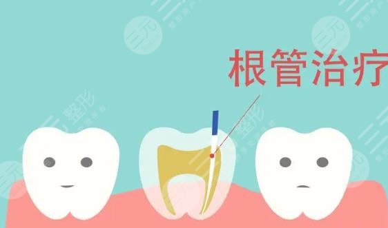 根管缓解