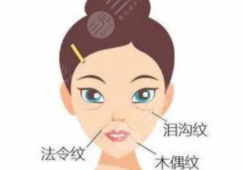 颞部拉皮能提升哪里