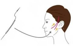 小拉皮手术能维持多久大概多少钱？小拉皮手术简介与注意事项分享！