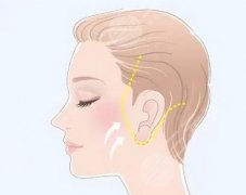 做一次拉皮能维持多久？维持效果要注意自身的护理环节！