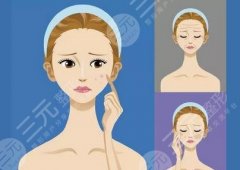 光子嫩肤一到七天图分享！光子嫩肤案例、价格、原理分享！