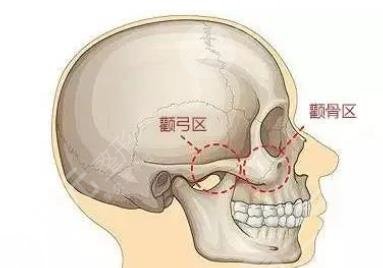 颧骨
