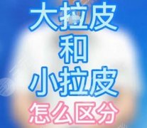 小拉皮和大拉皮的区别?分别介绍小拉皮和大拉皮、价格范围~ 小拉皮和大拉皮的区别?分别介绍小拉皮和大拉皮、价格范围~