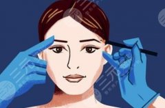 做大拉皮能保持多长时间？大拉皮是什么、三个注意事项要了解！