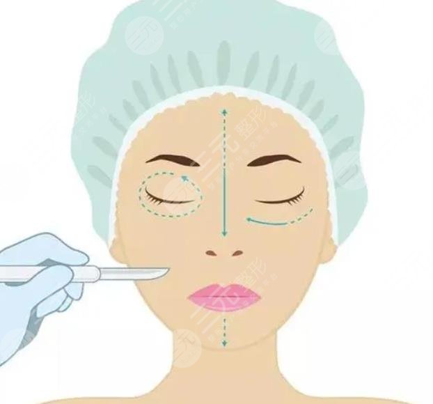 外切眼袋加眶隔释放加填充泪沟