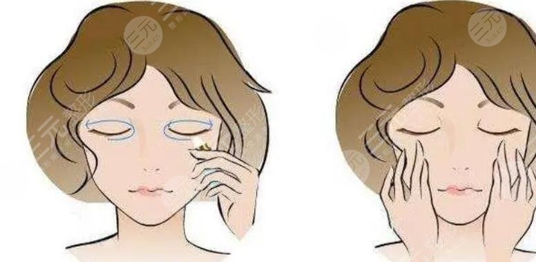 外切眼袋加眶隔释放加填充泪沟