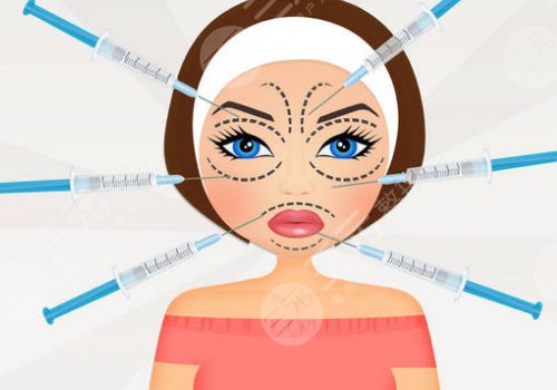 轮廓针可以打哪些地方？