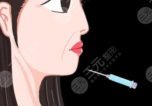 轮廓针真的有用吗？