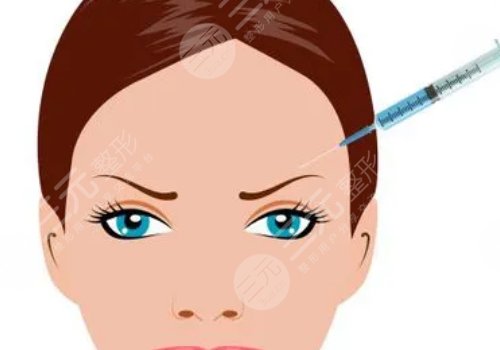 轮廓针真的有用吗？