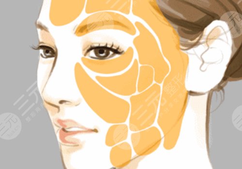 打造幼态脸需要做多少项目？
