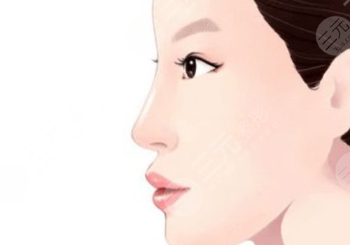 北京上上相医疗美容诊所脂肪隆鼻怎么样？