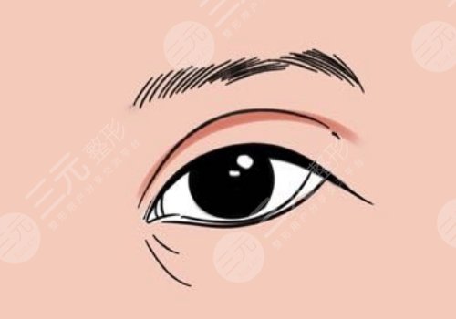 幼态脸需要做哪些整形项目？