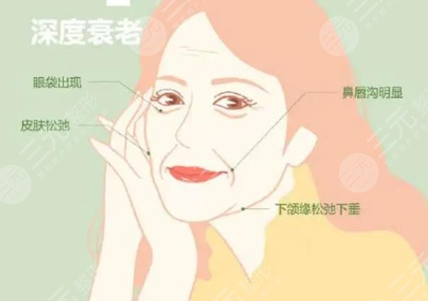 骨相抗衰