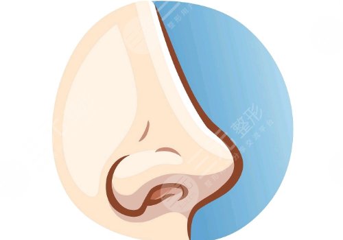 俞积贵做鼻子怎么样