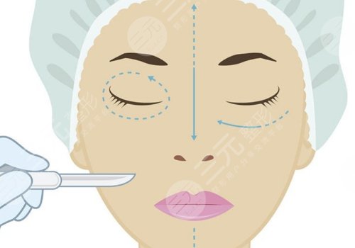 内轮廓是指哪里部位？