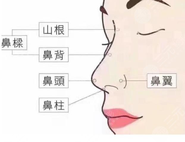北京维纳斯整形医院做鼻子怎么样?