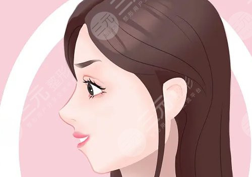 叶丽萍做鼻子怎么样