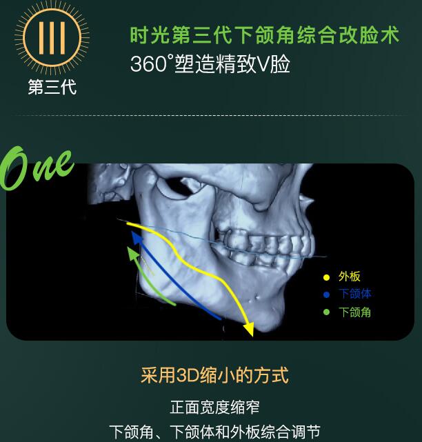 杭州时光医疗美容医院是三甲吗，技术怎么样？测评报告&价格一览！