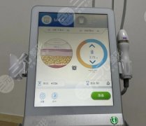 超声炮做一次全脸要多长时间?超声炮维持时间、护理注意事项~ 超声炮做一次全脸要多长时间?超声炮维持时间、护理注意事项~