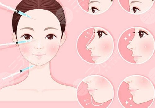 打玻尿酸10几年后