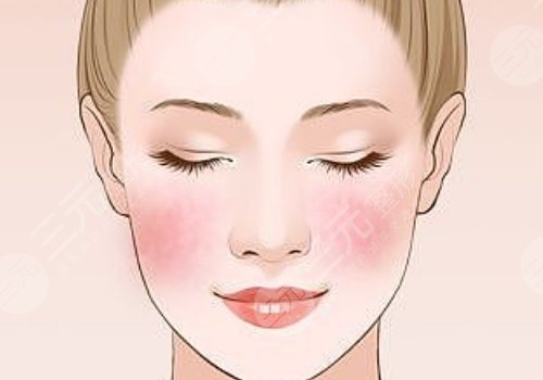 丰颜玻尿酸多久能消肿?