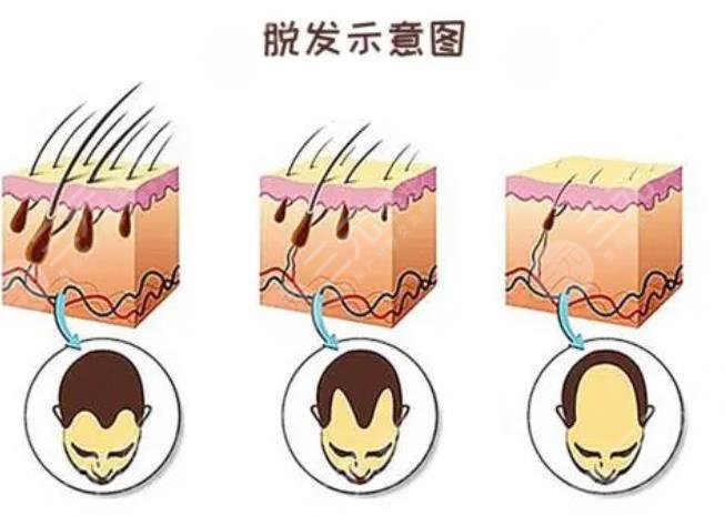 天津总医院植发科擅长项目