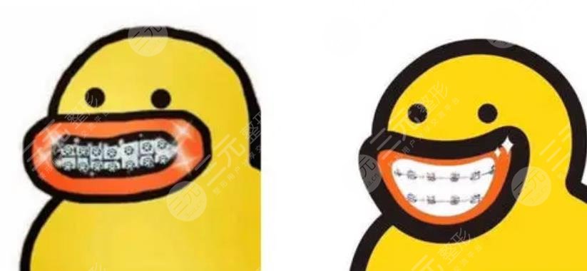 牙齿矫正