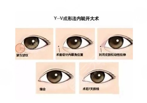 北京爱悦丽格医疗美容诊所怎么样