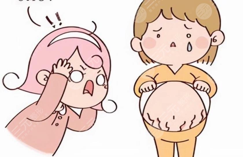 妊娠纹怎么消除