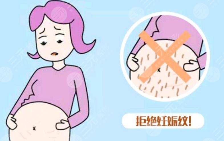 妊娠纹怎么消除