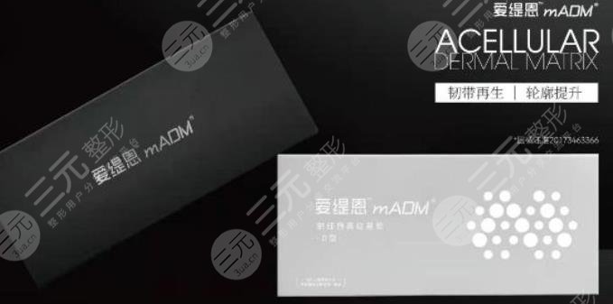 爱缇恩
