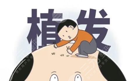植发