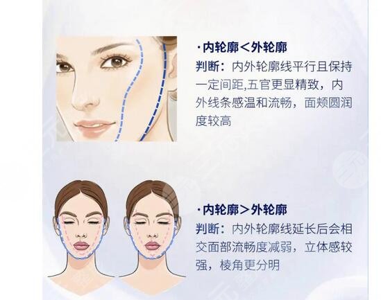 内轮廓是指哪里部位？