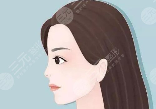 丰颜玻尿酸的优点