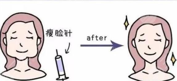 注射瘦脸