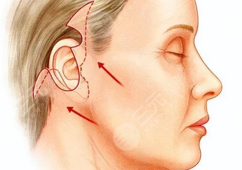 分层抗衰分别是哪些层？