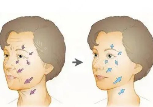 分层抗衰分别是哪些层？