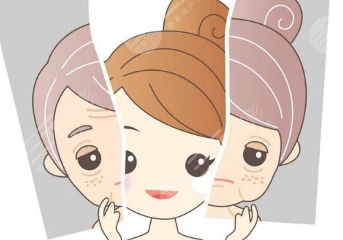 分层抗衰分别是哪些层？