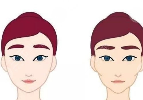 轮廓手术危险吗?