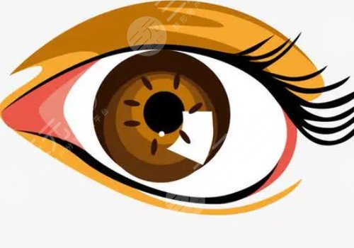 开眼角割双眼皮恢复期要多久？