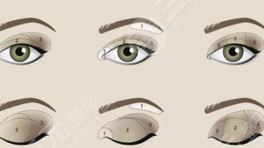 双眼皮修复
