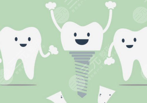 诺贝尔种植牙可以用多久